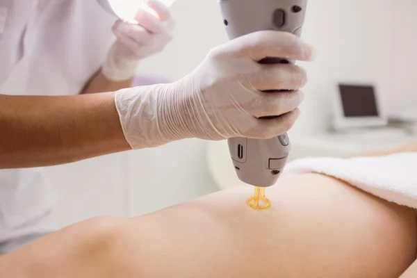 doctor-performing-laser-hair-removal doctor-performing-laser-hair-removal